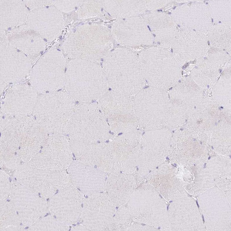 SLC38A5 Antibody - BSA Free Immunohistochemistry: SLC38A5 Antibody - BSA Free [NBP1-92402]