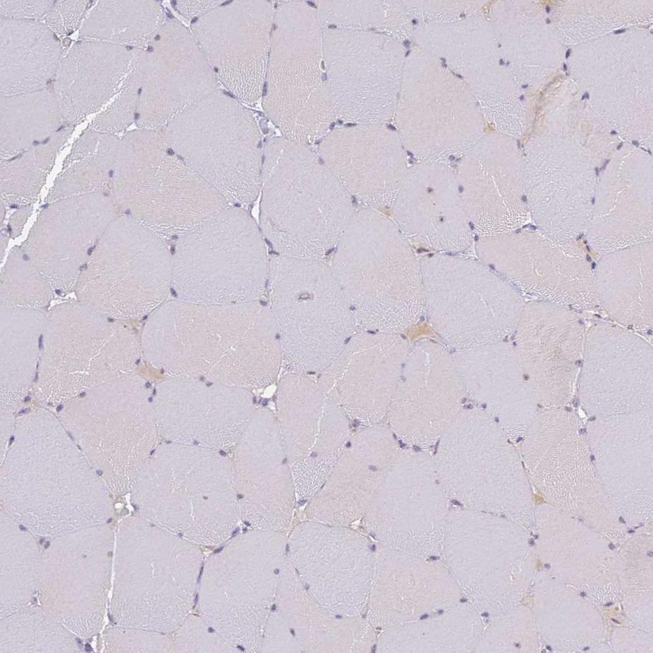 SLC38A9 Antibody - BSA Free Immunohistochemistry: SLC38A9 Antibody - BSA Free [NBP1-92403]