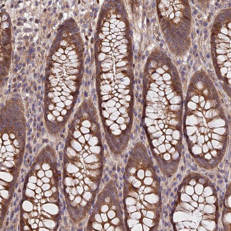 SMG6 Antibody - BSA Free Immunohistochemistry: SMG6 Antibody - BSA Free [NBP1-92410]