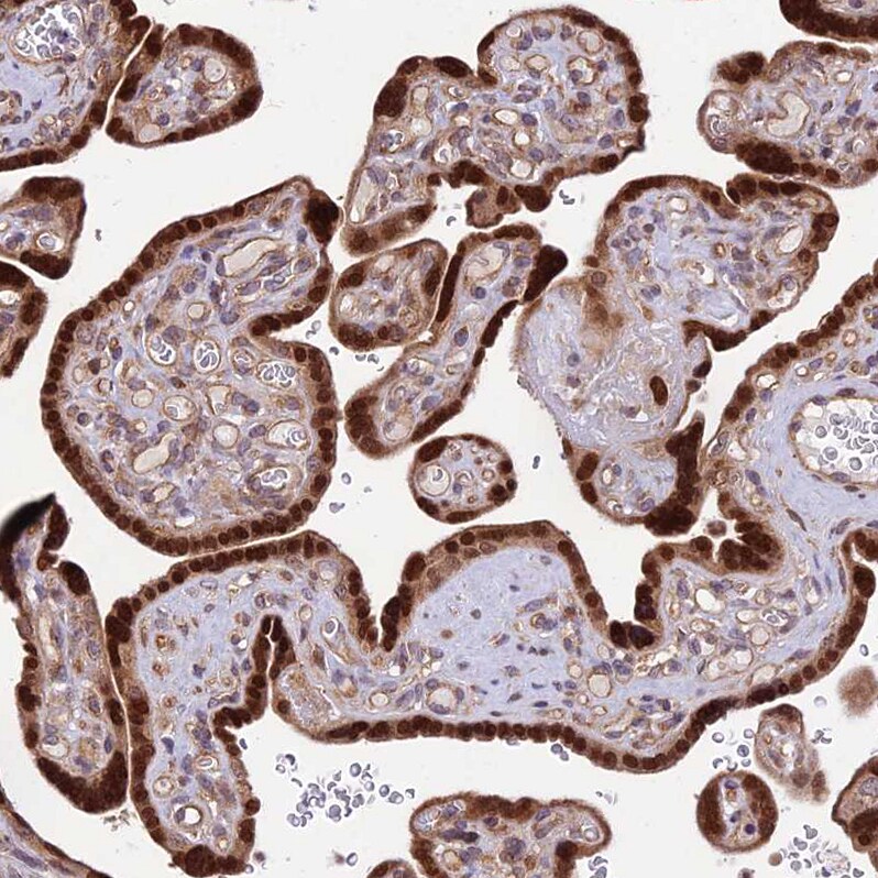 SMG6 Antibody - BSA Free Immunohistochemistry: SMG6 Antibody - BSA Free [NBP1-92410]