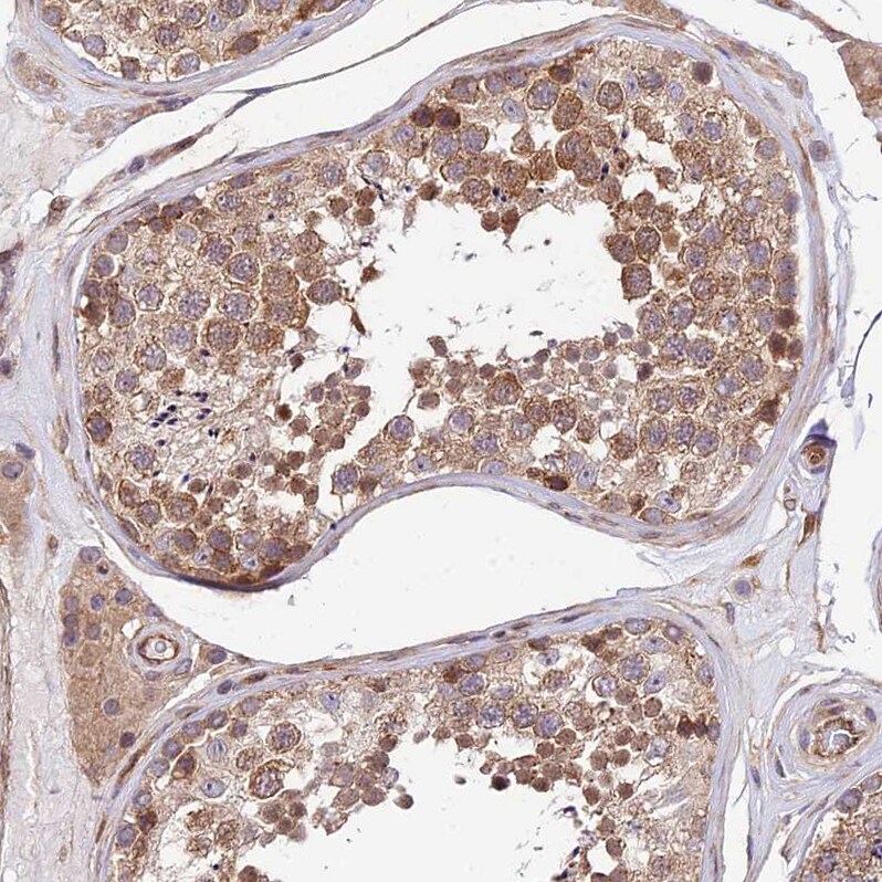 SMG6 Antibody - BSA Free Immunohistochemistry: SMG6 Antibody - BSA Free [NBP1-92410]