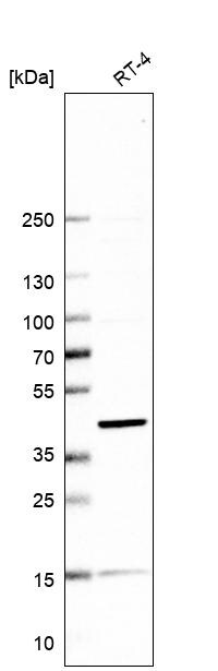 Sorting Nexin 31 Antibody - BSA Free Western Blot: Sorting Nexin 31 Antibody - BSA Free [NBP1-92423]