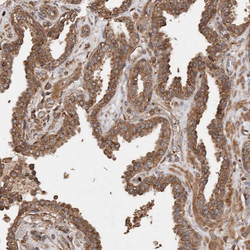 Sorting Nexin 31 Antibody - BSA Free Immunohistochemistry: Sorting Nexin 31 Antibody - BSA Free [NBP1-92423]
