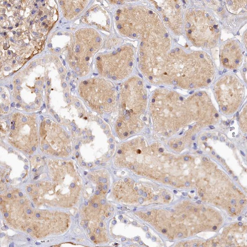 SPATA5L1 Antibody - BSA Free Immunohistochemistry: SPATA5L1 Antibody - BSA Free [NBP1-92430]