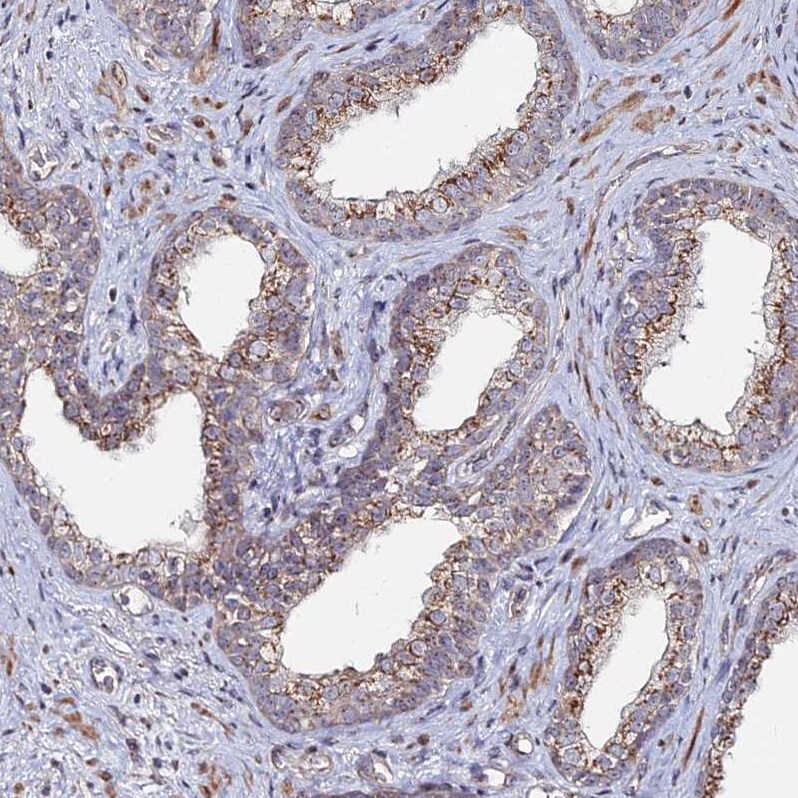 Sphingomyelin synthase 1 Antibody - BSA Free Immunohistochemistry: Sphingomyelin synthase 1 Antibody - BSA Free [NBP1-92435]