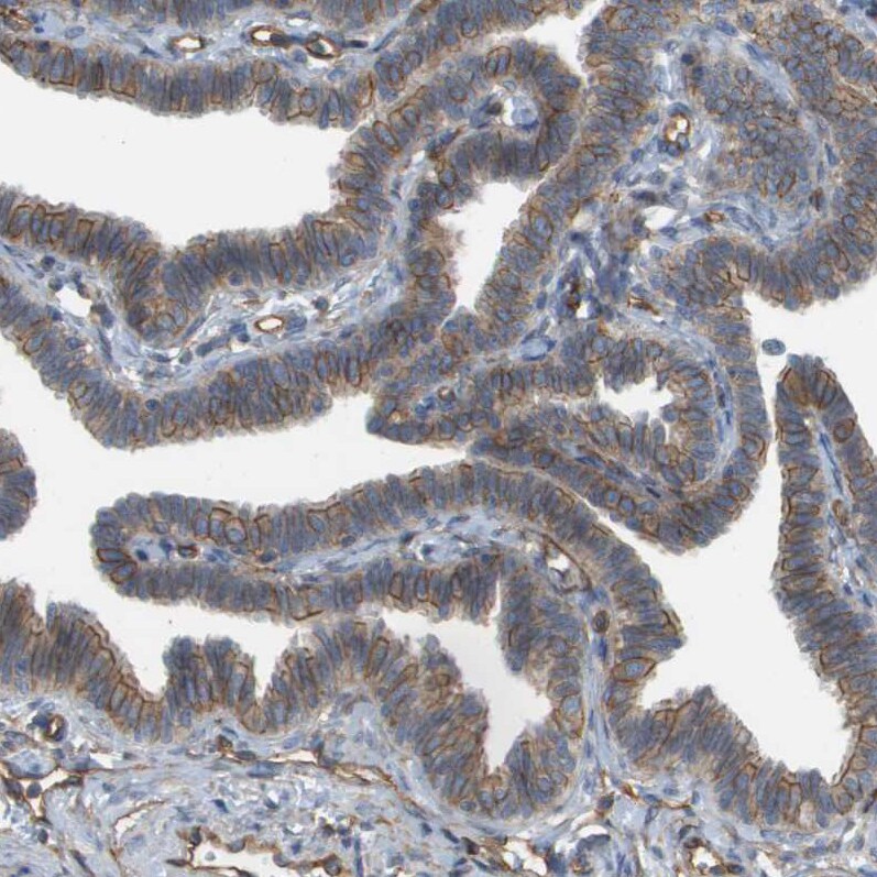 Sphingomyelin Synthase 2 Antibody - BSA Free Immunohistochemistry: Sphingomyelin Synthase 2 Antibody - BSA Free [NBP1-92436]