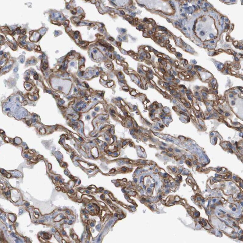 Sphingomyelin Synthase 2 Antibody - BSA Free Immunohistochemistry: Sphingomyelin Synthase 2 Antibody - BSA Free [NBP1-92436]
