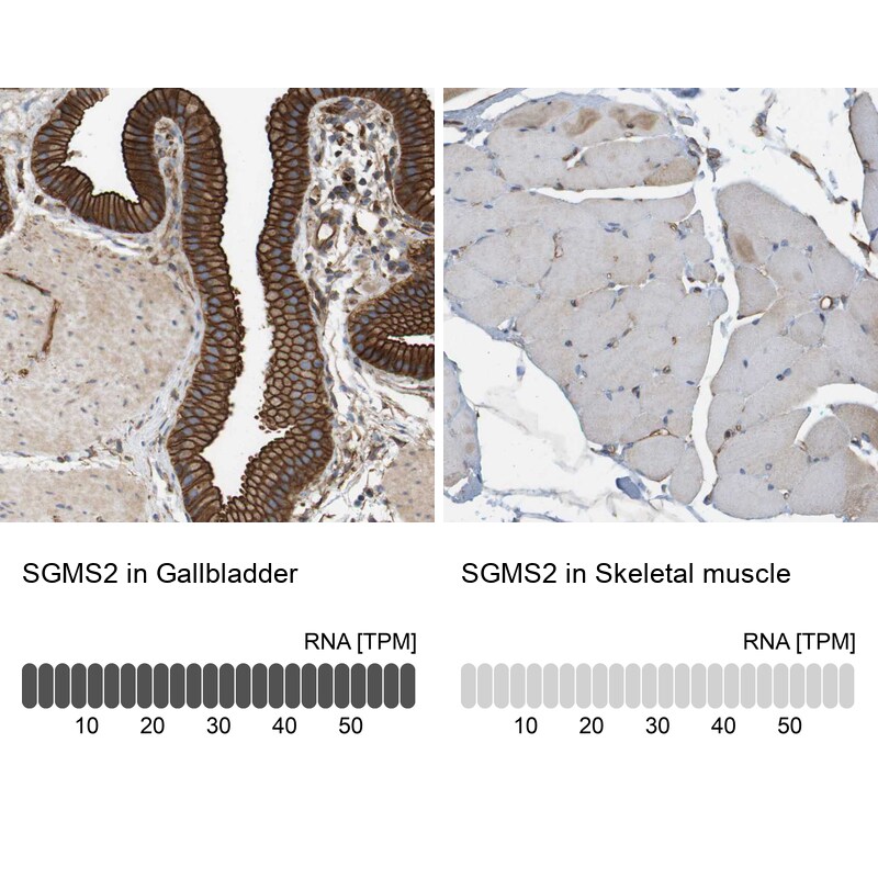 Sphingomyelin Synthase 2 Antibody - BSA Free Immunohistochemistry: Sphingomyelin Synthase 2 Antibody - BSA Free [NBP1-92436]
