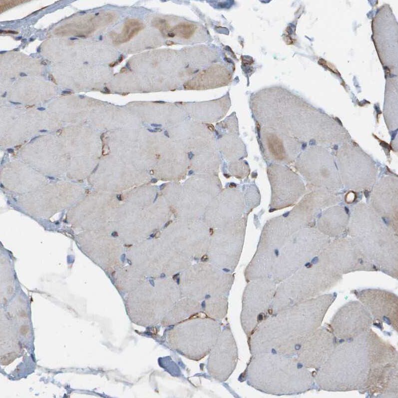 Sphingomyelin Synthase 2 Antibody - BSA Free Immunohistochemistry: Sphingomyelin Synthase 2 Antibody - BSA Free [NBP1-92436]