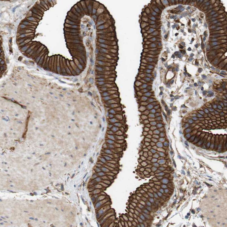 Sphingomyelin Synthase 2 Antibody - BSA Free Immunohistochemistry: Sphingomyelin Synthase 2 Antibody - BSA Free [NBP1-92436]