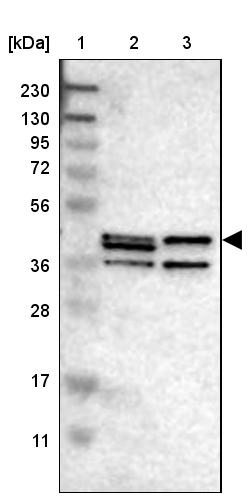 Sphingomyelin Synthase 2 Antibody - BSA Free Western Blot: Sphingomyelin Synthase 2 Antibody - BSA Free [NBP1-92436]