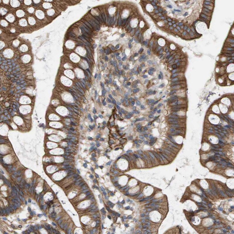 Sphingomyelin Synthase 2 Antibody - BSA Free Immunohistochemistry: Sphingomyelin Synthase 2 Antibody - BSA Free [NBP1-92436]