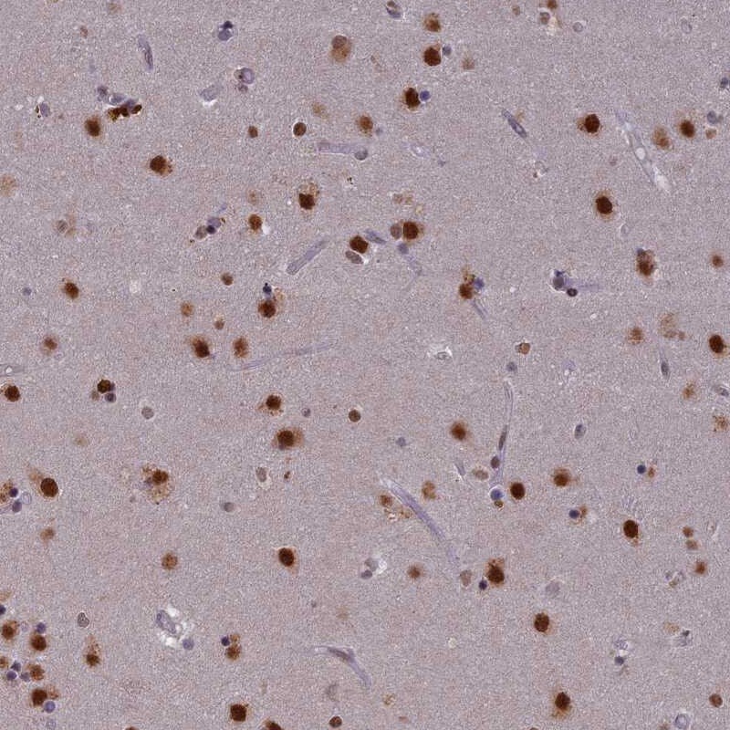 SPIRE1 Antibody - BSA Free Immunohistochemistry-Paraffin: SPIRE1 Antibody [NBP1-92438]