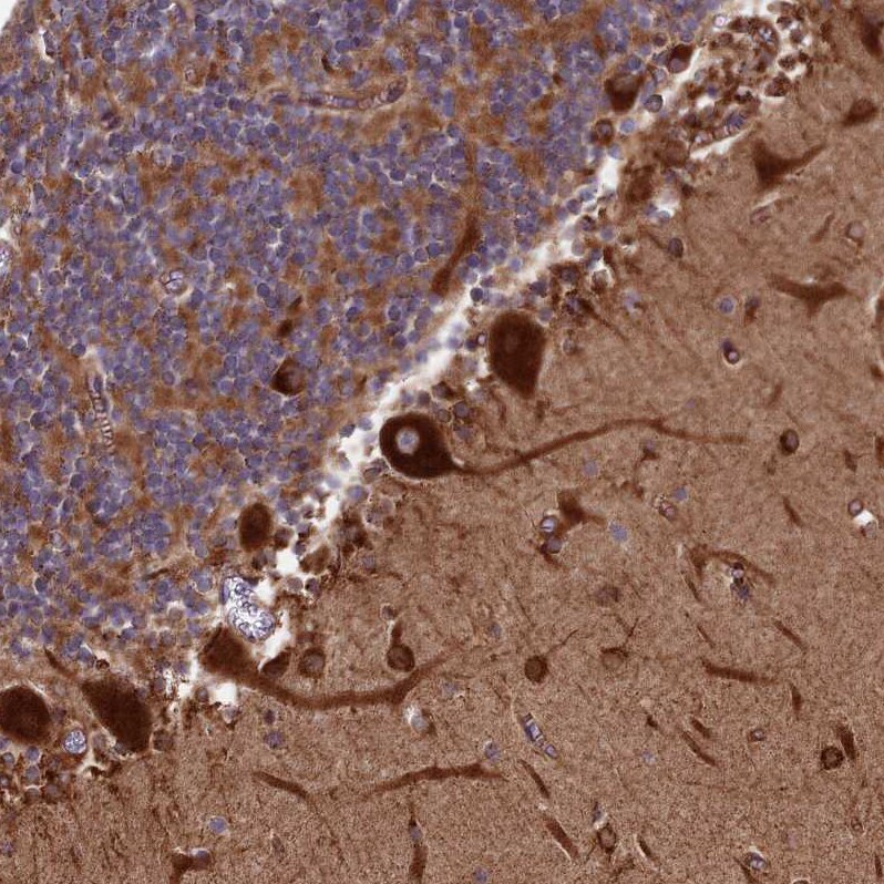 Testican 2/SPOCK2 Antibody - BSA Free Immunohistochemistry: Testican 2/SPOCK2 Antibody - BSA Free [NBP1-92442]