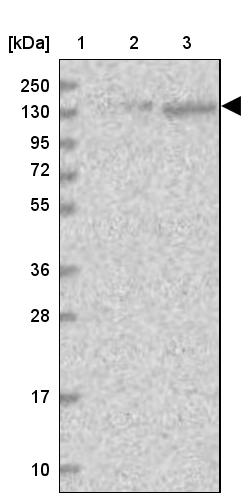SR140 Antibody - BSA Free Western Blot: SR140 Antibody - BSA Free [NBP1-92444]