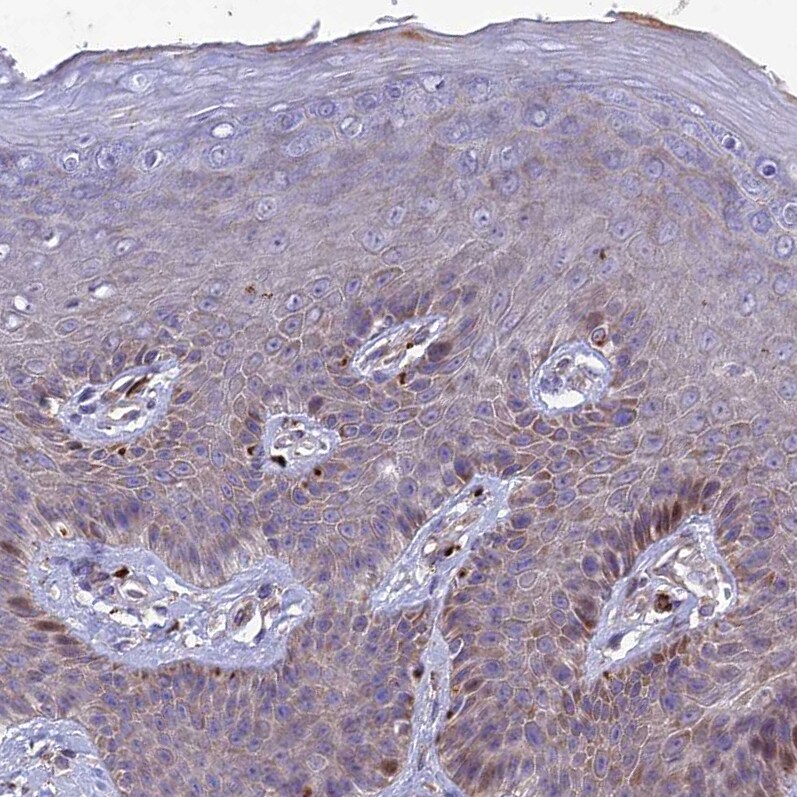ST3GAL6 Antibody - BSA Free Immunohistochemistry: ST3GAL6 Antibody - BSA Free [NBP1-92446]