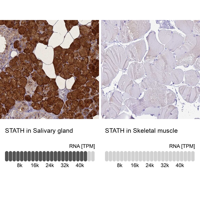 STATH Antibody - BSA Free Immunohistochemistry: STATH Antibody - BSA Free [NBP1-92450]