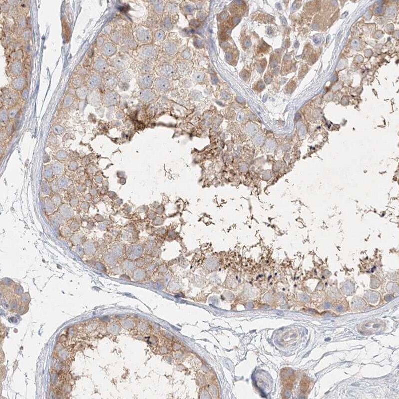 STK11IP Antibody - BSA Free Immunohistochemistry: STK11IP Antibody - BSA Free [NBP1-92451]