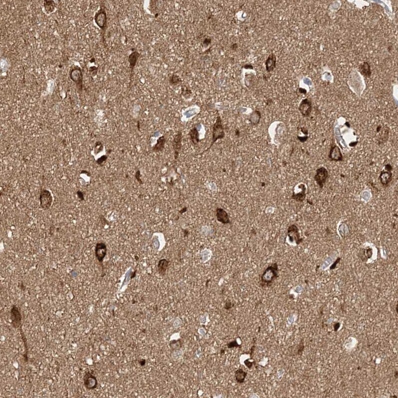 STK11IP Antibody - BSA Free Immunohistochemistry: STK11IP Antibody - BSA Free [NBP1-92451]