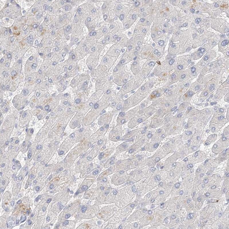STK11IP Antibody - BSA Free Immunohistochemistry: STK11IP Antibody - BSA Free [NBP1-92451]