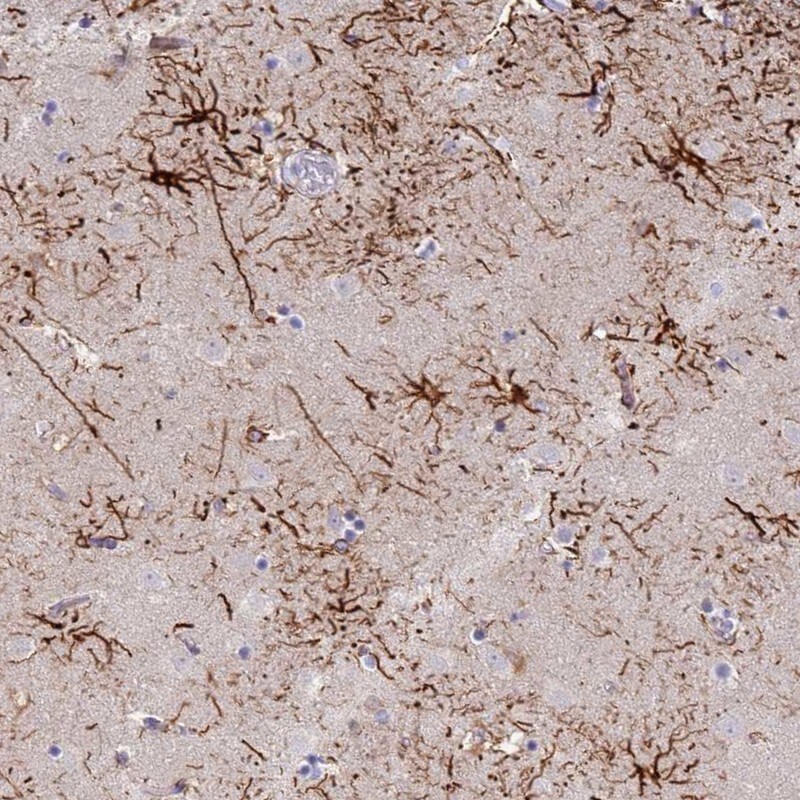 STK25 Antibody - BSA Free Immunohistochemistry: STK25 Antibody - BSA Free [NBP1-92453]