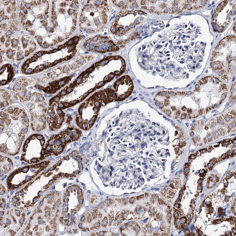 UBASH3B/STS1/Tula-2 Antibody - BSA Free Immunohistochemistry: UBASH3B/STS1/Tula-2 Antibody - BSA Free [NBP1-92456]