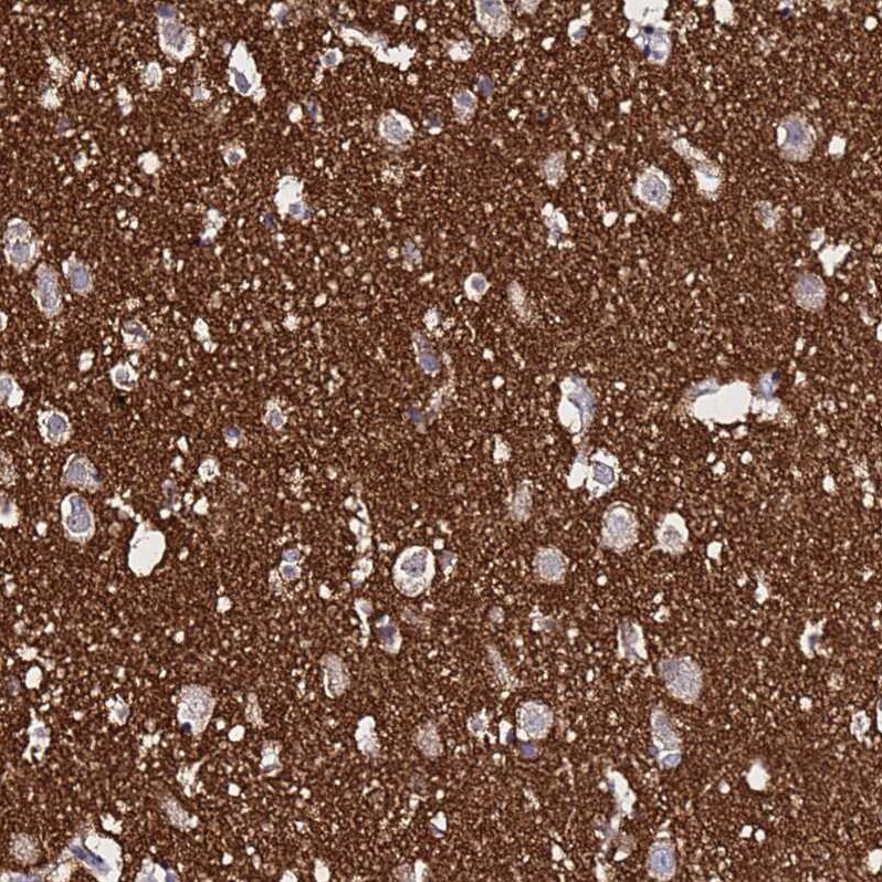 SV2B Antibody - BSA Free Immunohistochemistry: SV2B Antibody - BSA Free [NBP1-92462]