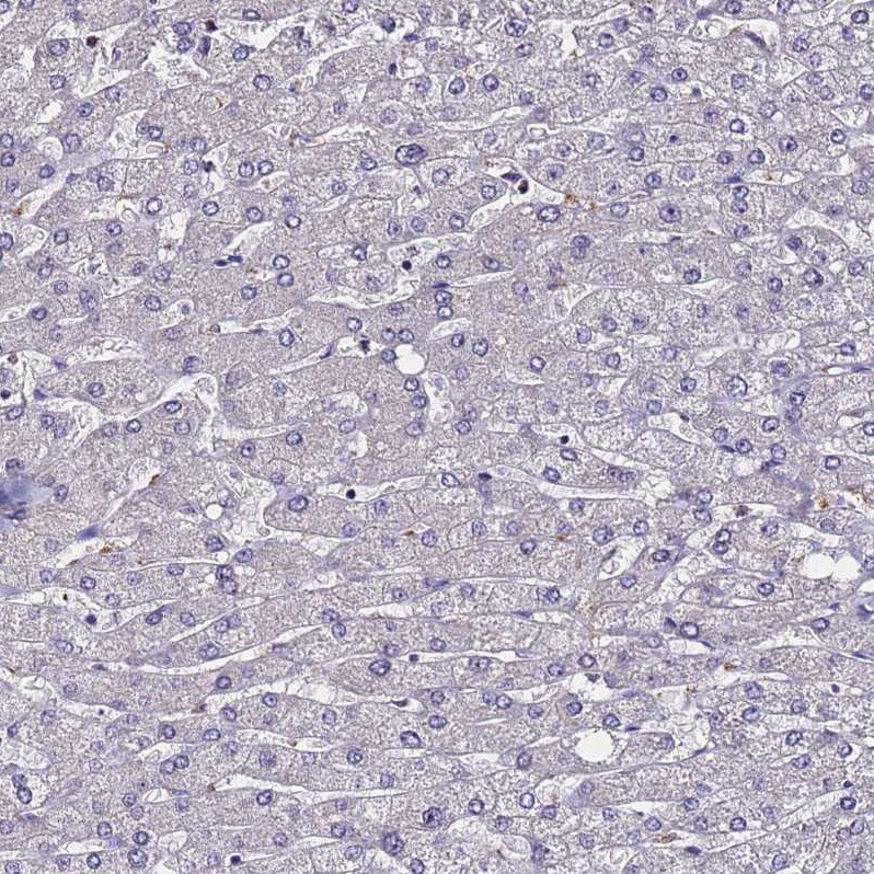 SV2B Antibody - BSA Free Immunohistochemistry: SV2B Antibody - BSA Free [NBP1-92462]