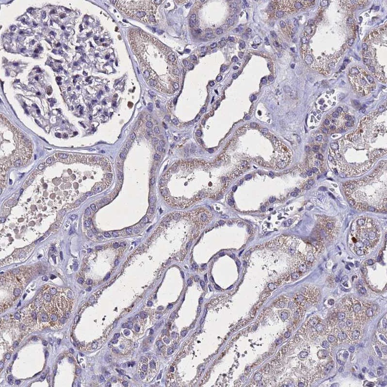 SV2B Antibody - BSA Free Immunohistochemistry: SV2B Antibody - BSA Free [NBP1-92462]