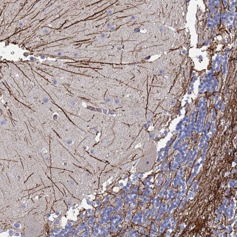 Synaptotagmin 13 Antibody - BSA Free Immunohistochemistry: Synaptotagmin 13 Antibody - BSA Free [NBP1-92466]
