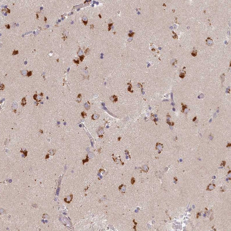 Syntaxin 16 Antibody - BSA Free Immunohistochemistry-Paraffin: Syntaxin 16 Antibody [NBP1-92467]