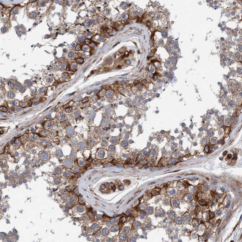 Syntaxin Binding Protein 4 Antibody - BSA Free Immunohistochemistry-Paraffin: Syntaxin Binding Protein 4 Antibody [NBP1-92470]
