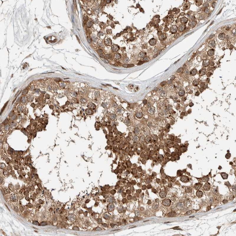 Syntaxin Binding Protein 4 Antibody - BSA Free Immunohistochemistry-Paraffin: Syntaxin Binding Protein 4 Antibody [NBP1-92471]