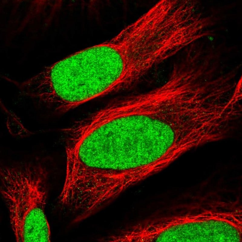 TAF13 Antibody - BSA Free Immunocytochemistry/ Immunofluorescence: TAF13 Antibody - BSA Free [NBP1-92474]