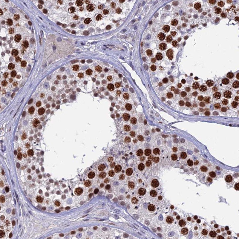TAF9b Antibody - BSA Free Immunohistochemistry: TAF9b Antibody - BSA Free [NBP1-92475]