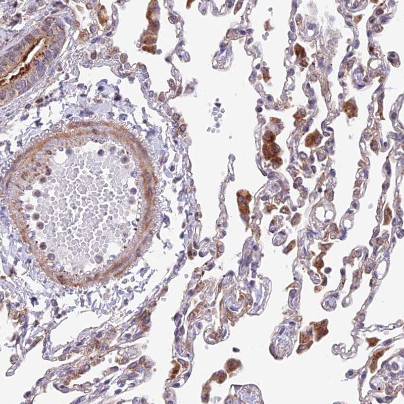 TBC1D20 Antibody - BSA Free Immunohistochemistry: TBC1D20 Antibody - BSA Free [NBP1-92478]