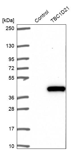 TBC1D21 Antibody - BSA Free Western Blot: TBC1D21 Antibody - BSA Free [NBP1-92479]