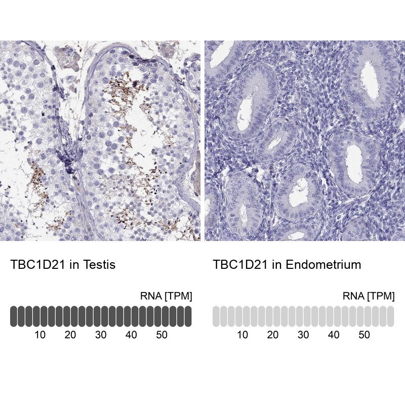 TBC1D21 Antibody - BSA Free Immunohistochemistry: TBC1D21 Antibody - BSA Free [NBP1-92479]