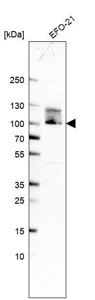 TBL3 Antibody - BSA Free Western Blot: TBL3 Antibody - BSA Free [NBP1-92481]