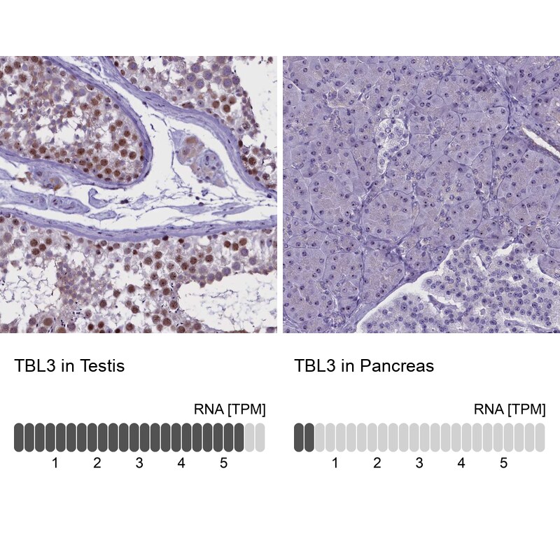 TBL3 Antibody - BSA Free Immunohistochemistry: TBL3 Antibody - BSA Free [NBP1-92481]
