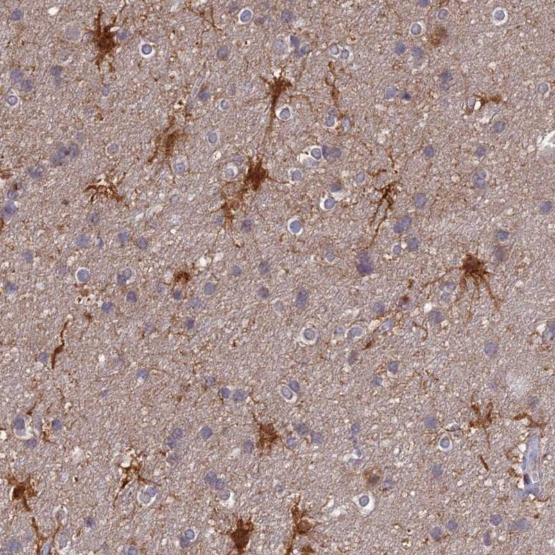 TCEB3B Antibody - BSA Free Immunohistochemistry: TCEB3B Antibody - BSA Free [NBP1-92483]
