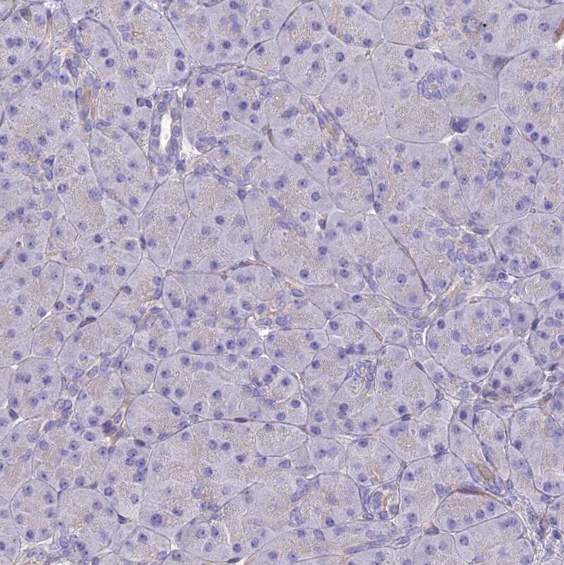 TEKT3 Antibody - BSA Free Immunohistochemistry: TEKT3 Antibody - BSA Free [NBP1-92488]