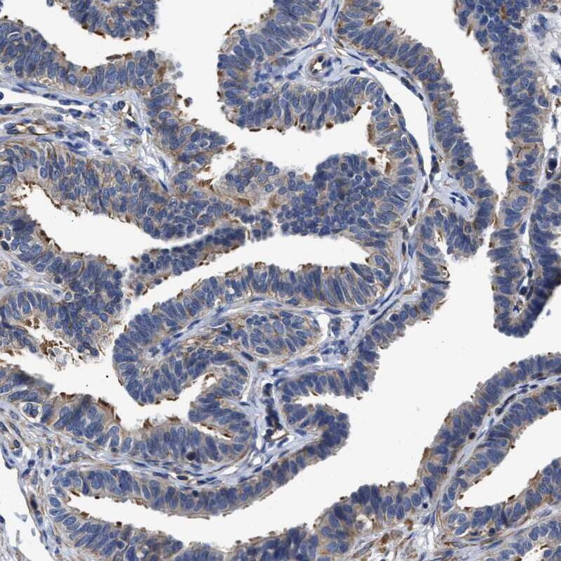 TSPAN33 Antibody - BSA Free Immunohistochemistry: TSPAN33 Antibody - BSA Free [NBP1-92490]