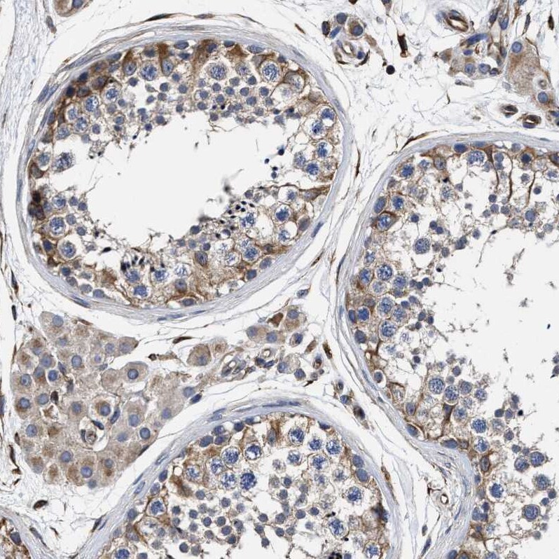 TSPAN33 Antibody - BSA Free Immunohistochemistry: TSPAN33 Antibody - BSA Free [NBP1-92490]