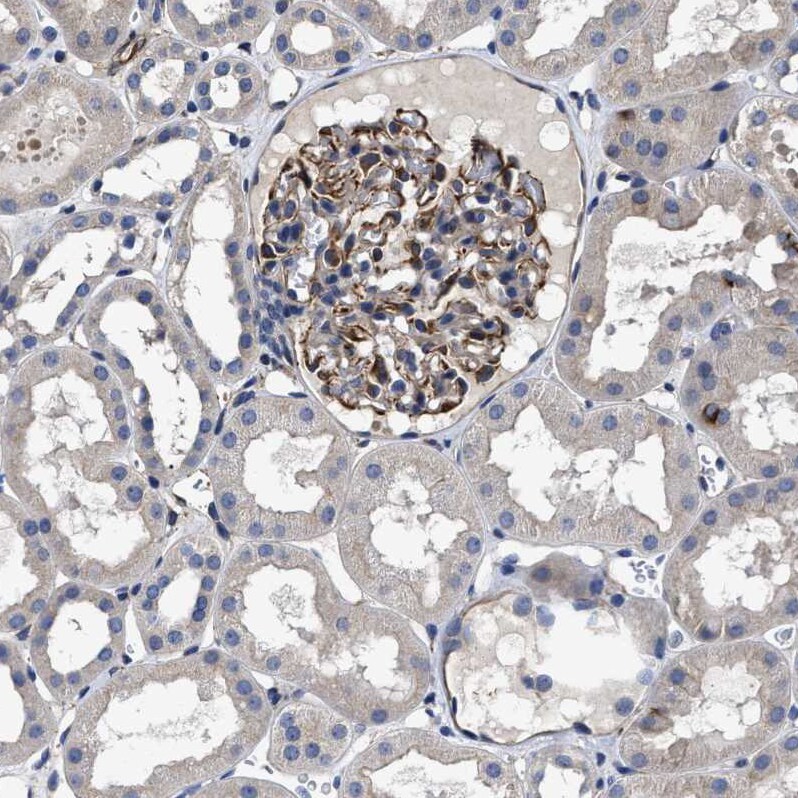 TSPAN33 Antibody - BSA Free Immunohistochemistry: TSPAN33 Antibody - BSA Free [NBP1-92490]