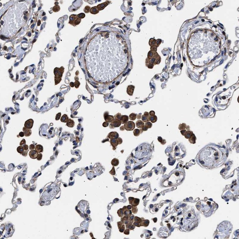 TSPAN33 Antibody - BSA Free Immunohistochemistry: TSPAN33 Antibody - BSA Free [NBP1-92490]
