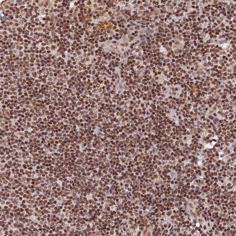 THAP11 Antibody - BSA Free Immunohistochemistry: THAP11 Antibody - BSA Free [NBP1-92494]