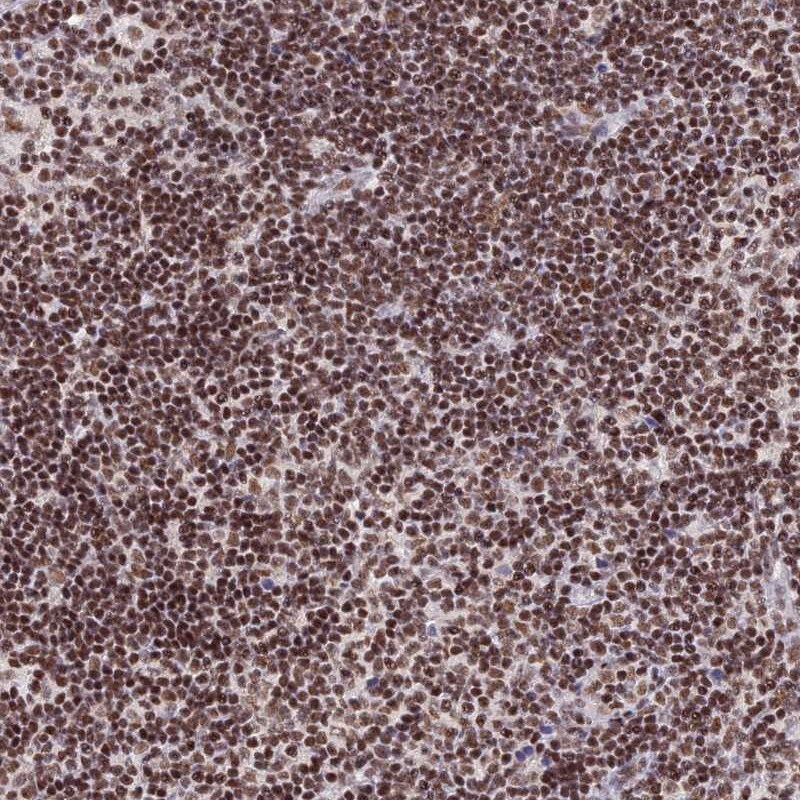 THAP11 Antibody - BSA Free Immunohistochemistry: THAP11 Antibody - BSA Free [NBP1-92495]