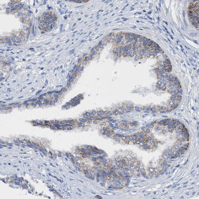 THEM2 Antibody - BSA Free Immunohistochemistry: THEM2 Antibody - BSA Free [NBP1-92498]