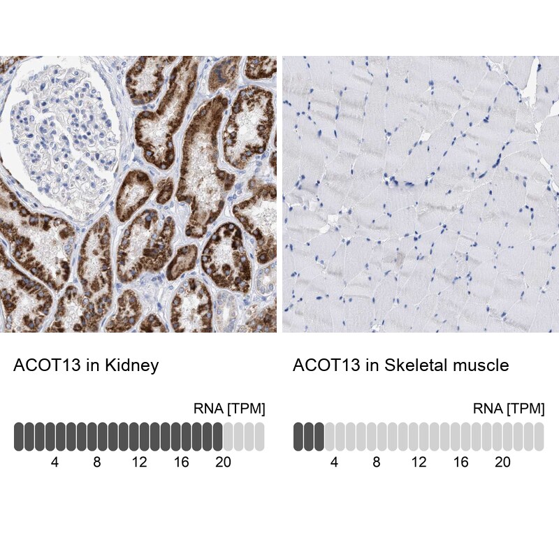 THEM2 Antibody - BSA Free Immunohistochemistry: THEM2 Antibody - BSA Free [NBP1-92498]